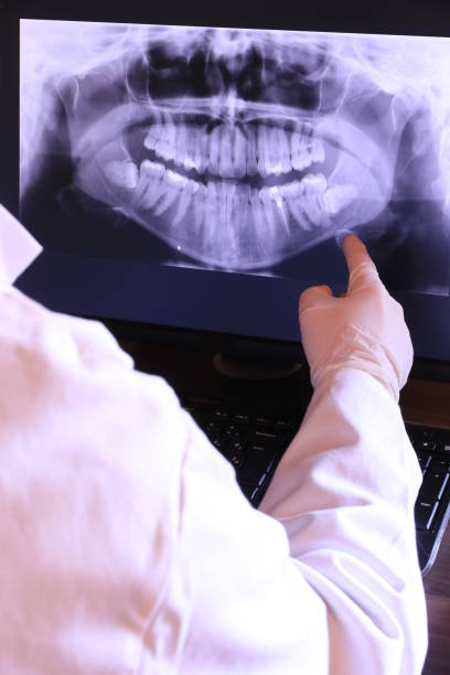 Best Emergency Dentist for Lost Fillings or Crowns in Oakland, NJ