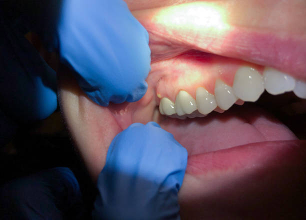 Best Emergency Dentist for Knocked-Out Tooth in Oakland, NJ